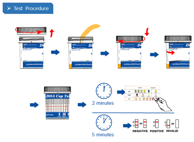Test procedure Test procedure
